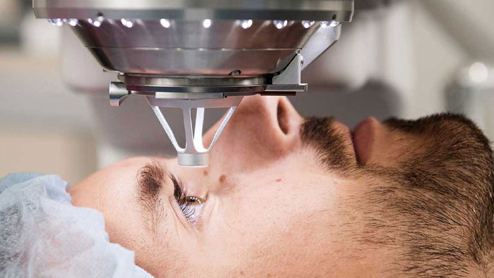 مزایا عمل فمتولیزیک