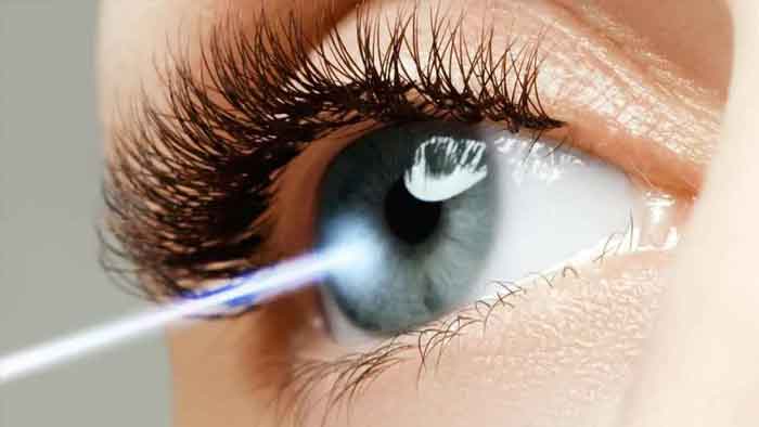 هزینه عمل لیزیک چشم