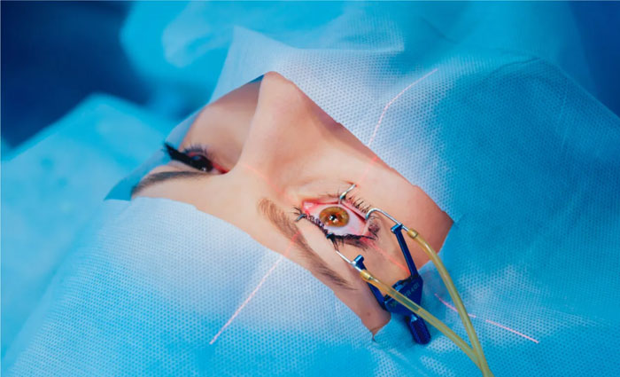 عمل پی ار کی چیست؟