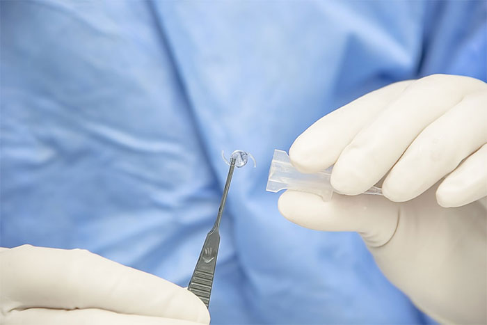 کاشت لنز داخل چشمی چیست؟