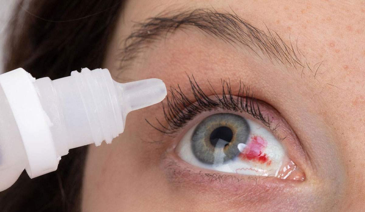 فشار چشم چیست و چه علتی دارد؟